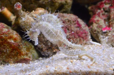 Atrophie hippocampique scheltens : comprendre l'impact en 2026 et au-delà